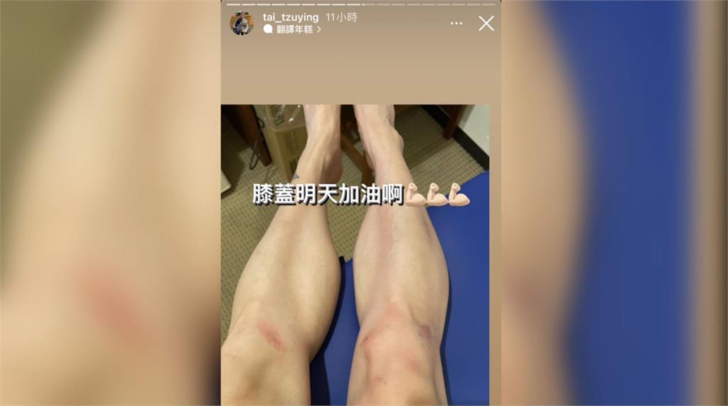 戴資穎PO出「膝蓋擦傷照」。圖／翻攝自Instagram@tai_tzuying