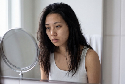 太焦慮的人臉會變怎樣？醫曝「4大特徵」  黑眼圈只是開始