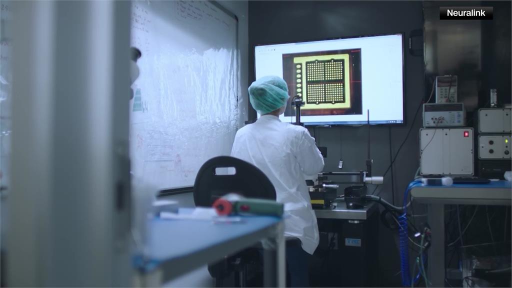 Neuralink今年1月底為首位患者植入大腦晶片。圖／美聯社、路透社、CNN