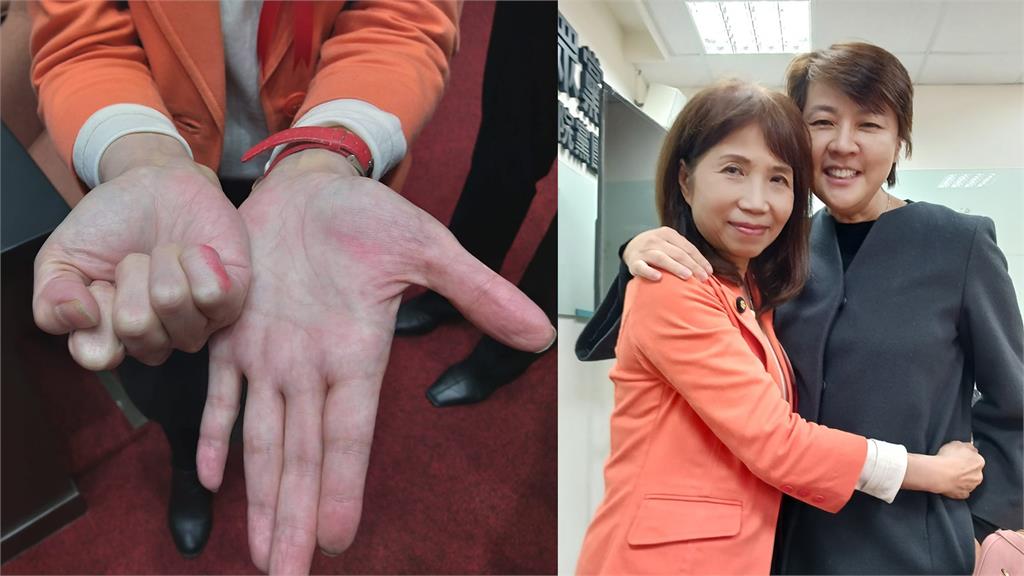 民眾黨立委陳昭姿手指沾印泥，導致選票污損被認定無效票。圖／翻攝自Facebook@Janice.chen.142、taipei33