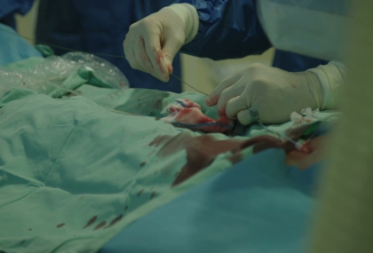 心導管檢查血管通路怎麼選？從股動脈到橈動脈 醫揭新趨勢降併發症