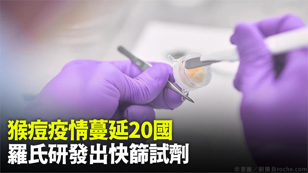 瑞士羅氏大藥廠表示，已研發出3款可檢測猴痘病毒的快篩試劑。圖／翻攝自AP Direct