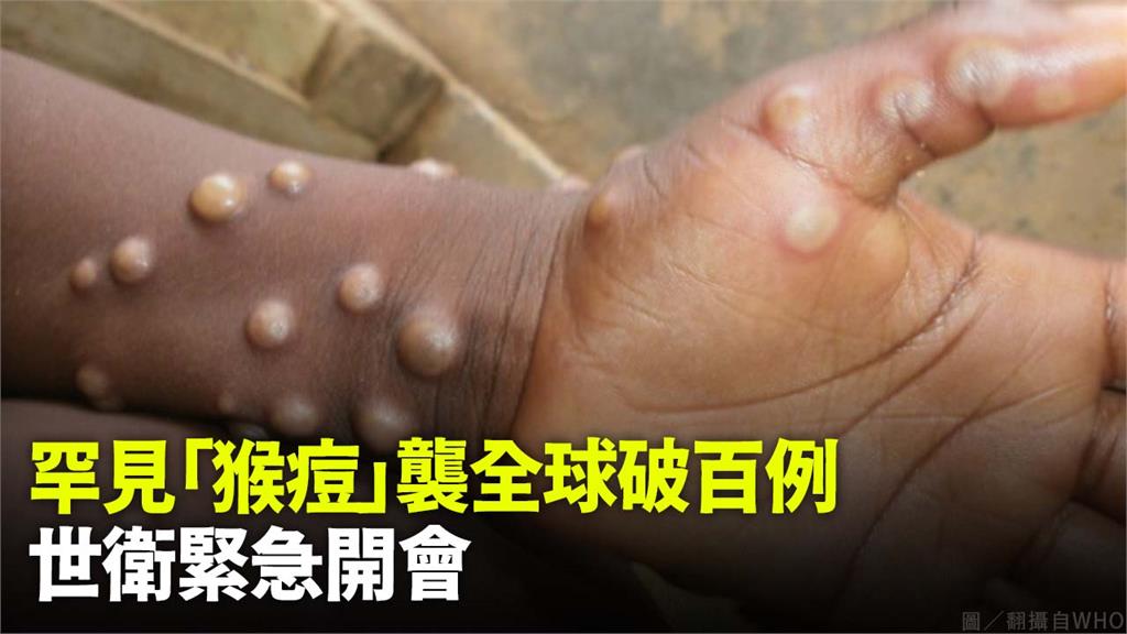 世界衛生組織（WHO）召開緊急會議，討論最近爆發的「猴痘」傳染疾病。圖／翻攝自WHO