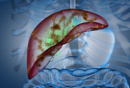 醫警告「4習慣不改」恐突然爆猛爆性肝炎！ 天天吞保健品也中招