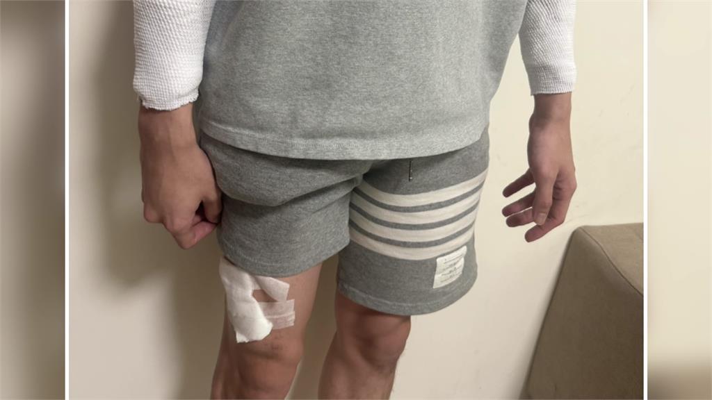 苗栗護理師遭刺傷案是「自導自演」 男辯工作壓力大遭法辦