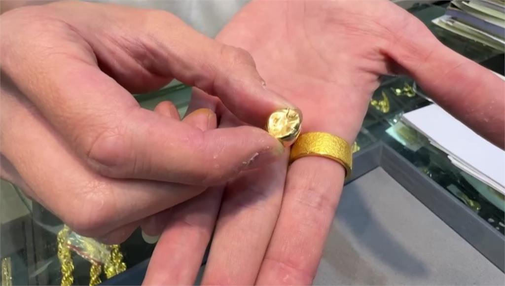 金價飆！高雄男摘18K金牙 1顆變賣逾4千元