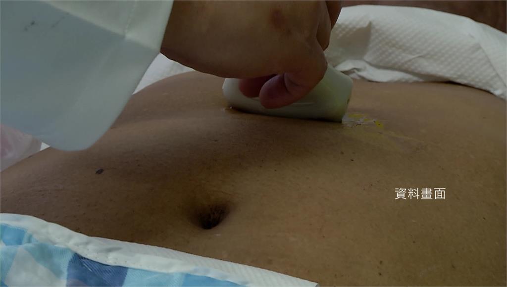 非B.C肝族群也會得肝癌！最新研究揭2基因變異「風險飆3.4倍」