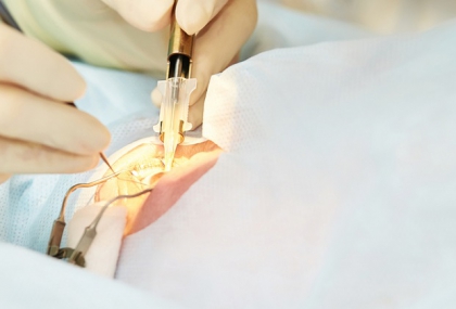 雷射近視後「5大地雷行為」恐影響視力！ 醫嚴厲警告