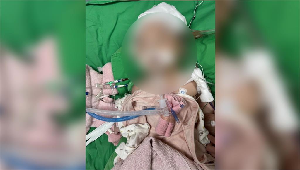 女嬰托育竟腦重創5度開顱 保母測謊未過卻獲不起訴