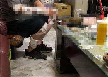 潘男遭比特犬攻擊後，手腳等多處都受傷。圖：翻攝自大里人聊天室