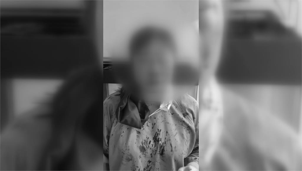 洗牙太痛？ 21歲男暴怒「痛毆女牙醫」診所濺血