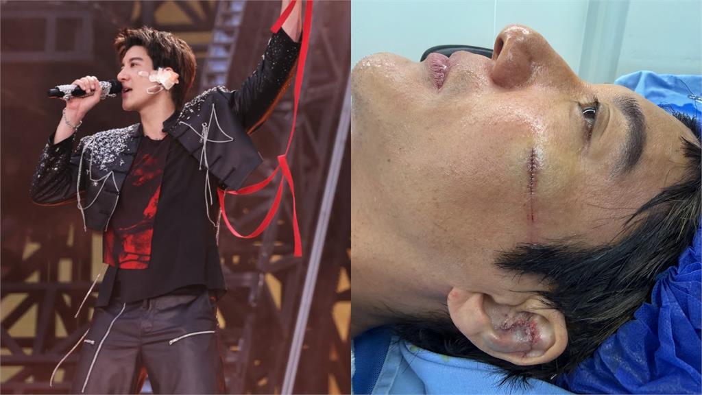 王力宏演唱會重摔！撞碎外耳軟骨送醫縫39針 深夜發聲親曝傷勢