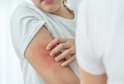 洗完澡「這時間內」擦乳液最保濕！皮膚科醫師：很多人都太晚擦