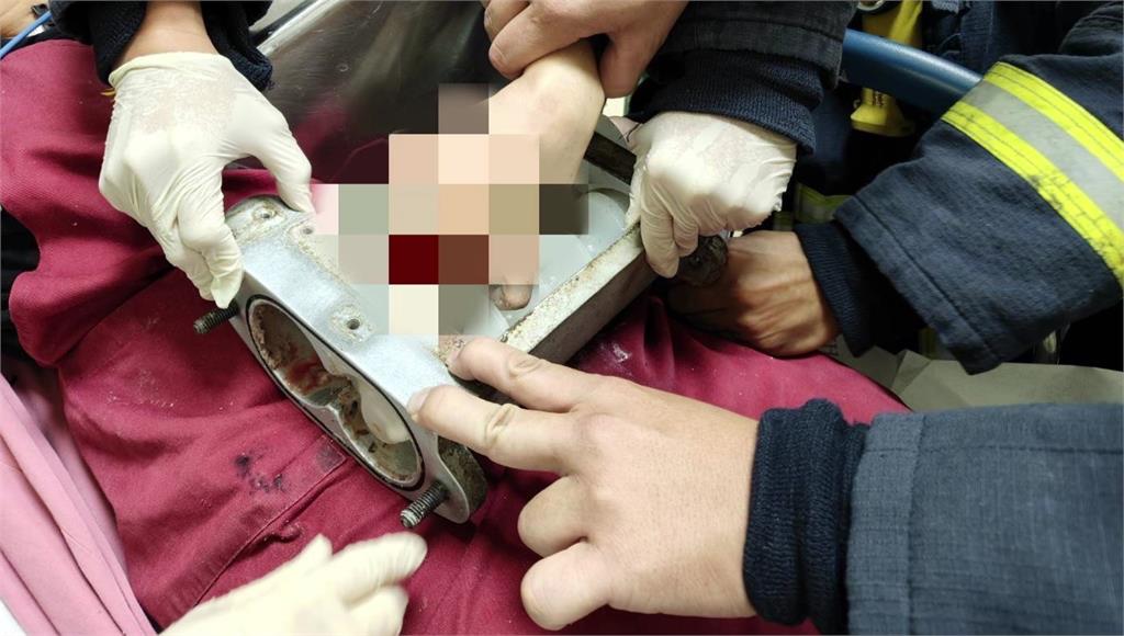 台中百年餅店員工「手指遭機器捲入」 3指重創送醫