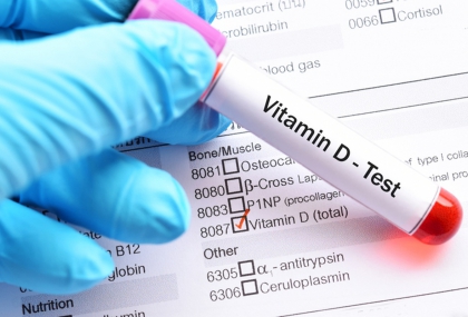 維生素D怎麼補才有效？ 曬太陽、食物與補充劑全攻略