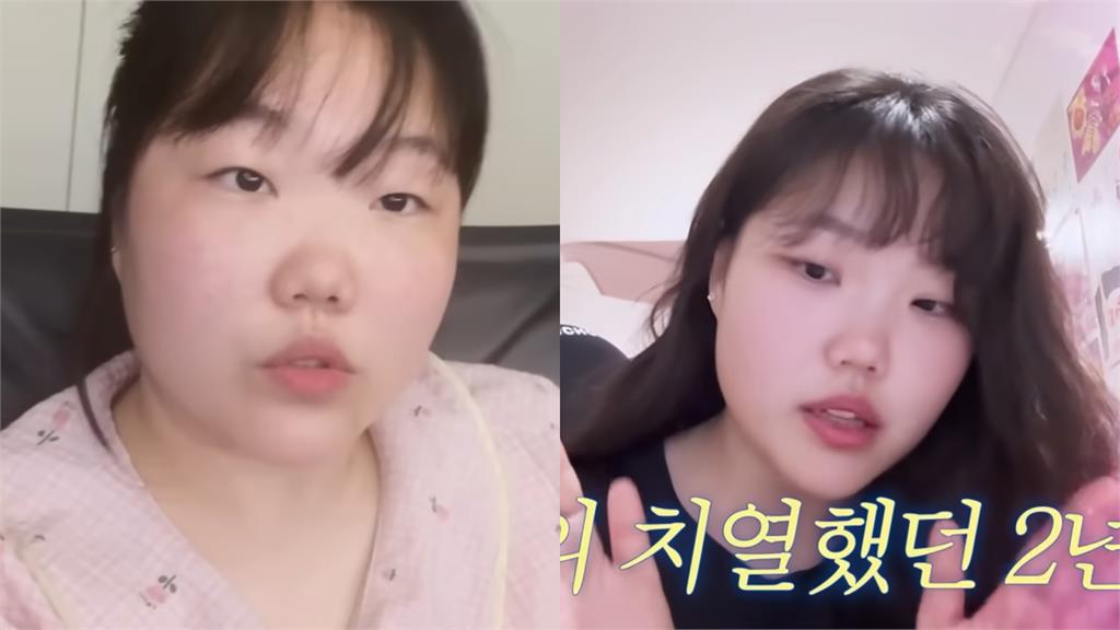 AKMU秀賢挺過低潮暴瘦30KG 曝親哥「魔鬼訓練」救了她