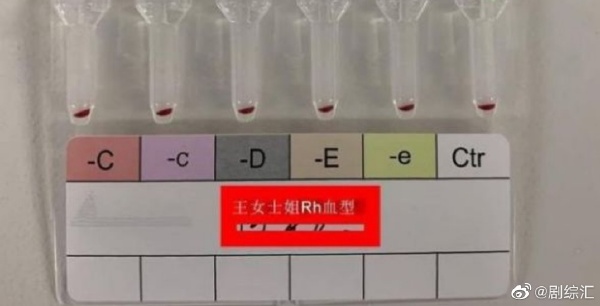 中國江蘇發現2例罕見「黃金血型」。圖／翻攝自微博@劇總匯