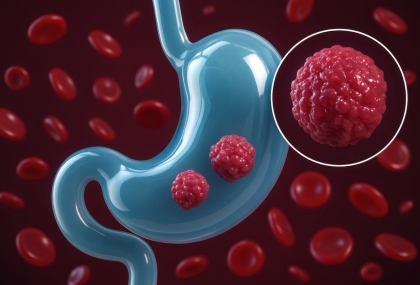 預防胃癌再升級！115年起全面推動公費幽門螺旋桿菌檢測