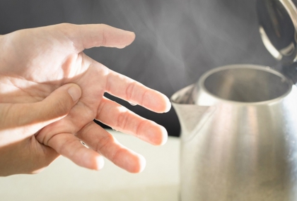 家中熱源暗藏危機！兒童燙傷防護「沖、脫、泡、蓋、送」五步驟必學