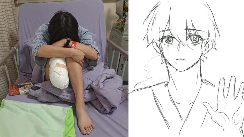 苗栗一名28歲女作業員的右小腿遭截肢。圖／翻攝自Facebook@曾玟學、@呂秋遠
