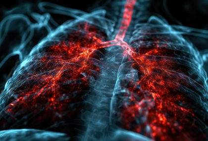 肺結節不等於肺癌！醫師：多數不必急著開刀 LDCT助早期發現