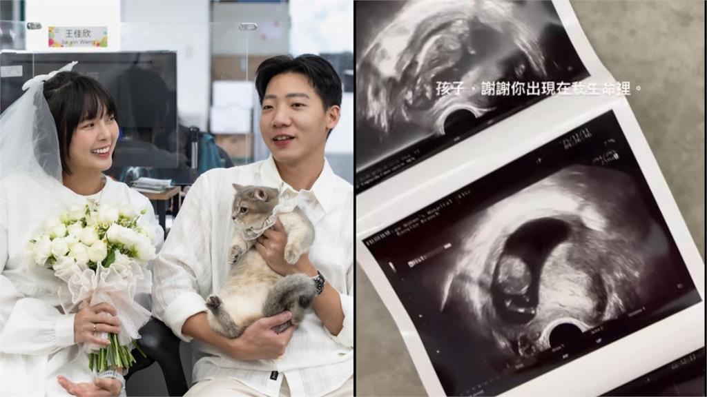 黃沐妍懷孕了！曬超音波照甜喊：謝謝陪我跑完三場馬拉松