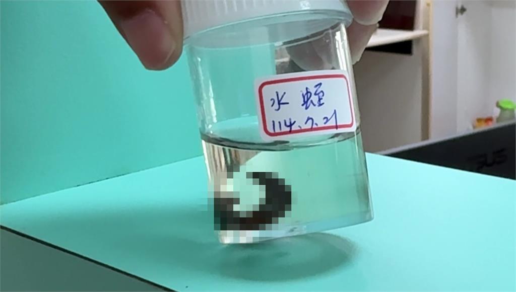戲水「寄生蟲上身」！ 男鼻腔驚見4公分水蛭