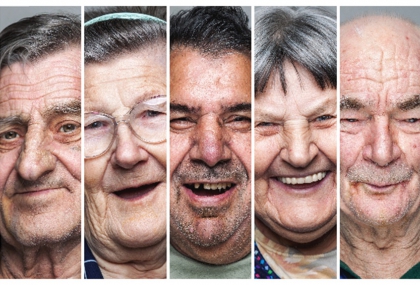 男人額頭皺紋多 心血管病致命率飆10倍