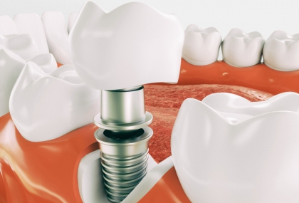 幹細胞重大突破：不只牙齒能再生 還能助長骨