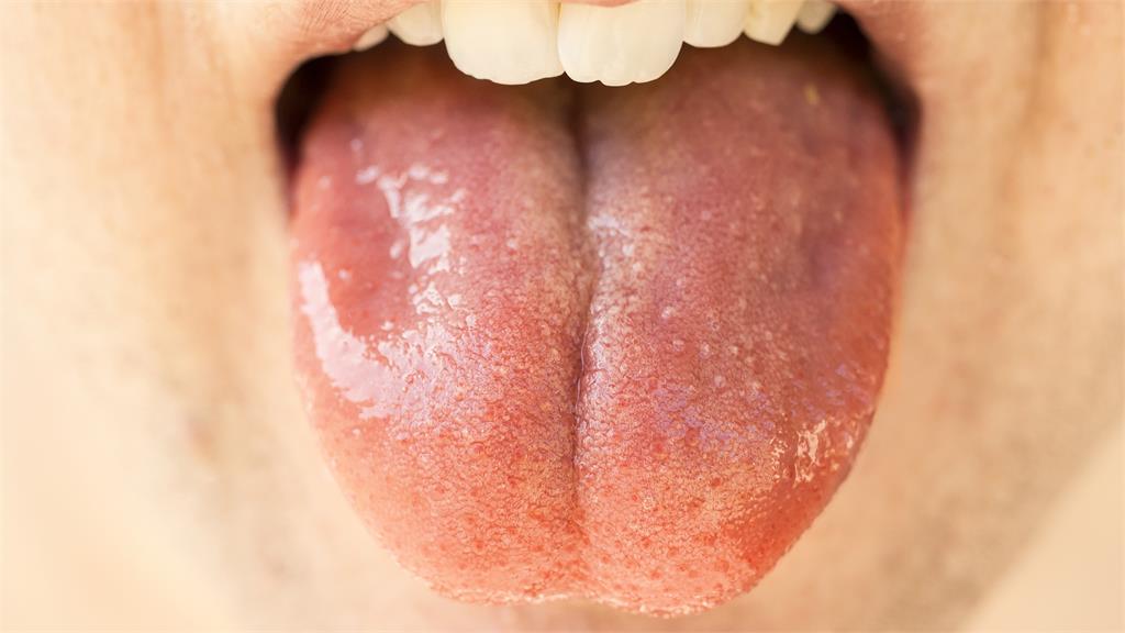 英國研發「唾液基因檢測」技術，號稱能以口水測出乳房健康程度。圖／Pixabay