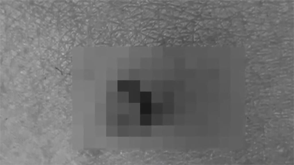 今年首例萊姆病 60多歲女性瑞典遭蚊蟲叮咬感染