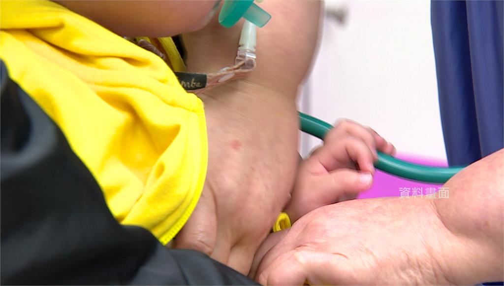 砸2.3億調升7項新生兒手術點數、3給付 健保署明年Q1上路盼留人才