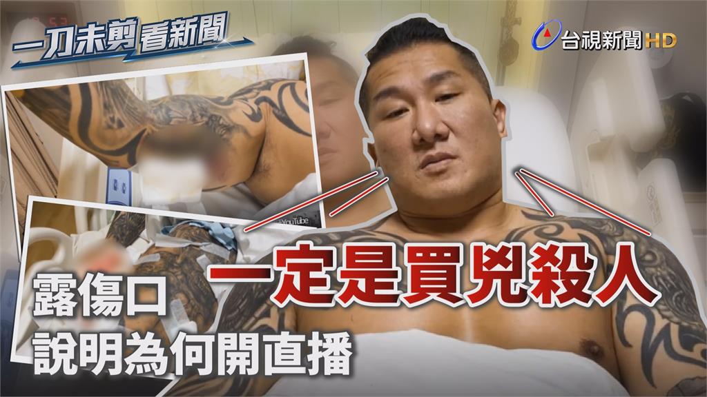 影／陳之漢住院露槍傷 控「一定是買兇殺人」